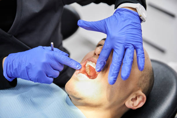 Best Emergency Dentist for Knocked-Out Tooth in North Granby, CT